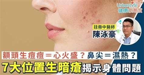 人中生瘡|【暗瘡中醫處理】額頭＝心火盛？鼻尖＝濕熱？7大位。